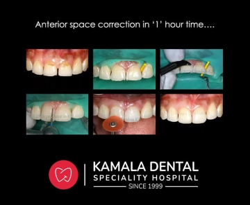 Anterior space correction in ‘1’ hour time