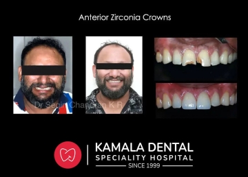 Are you confident of your smile??