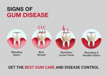 Early Signs of Gum Diseases
