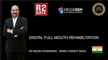Fix your teeth : Digital Full mouth Rehab @ Kamala Dental Thiruvananthapuram Kerala India