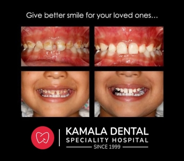 Give better smile for your loved ones