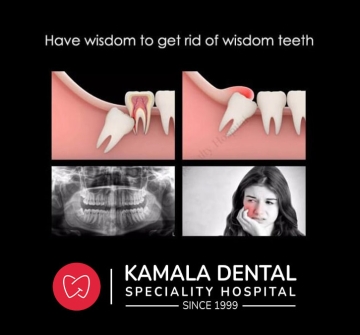 Have Wisdom to get rid of Wisdom Teeth
