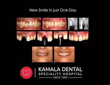 New smile in one day!