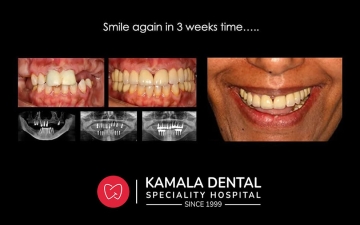 Smile again in 3 weeks time