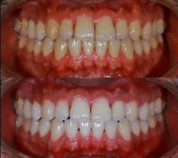 ‘Smile Brighter’ at Kamala Dental Specialty Hospital